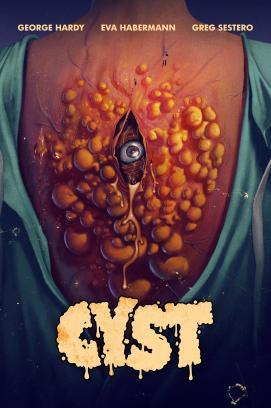 Cyst stream